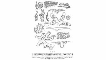 颈卵器分散簇生于叶状体背面,被以发育不全的鳞片状总苞.