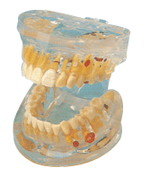 牙龈瘘管_360百科
