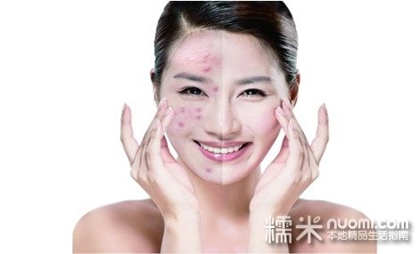 解放桥店专业祛痘祛印护理套餐!专业从事祛痘