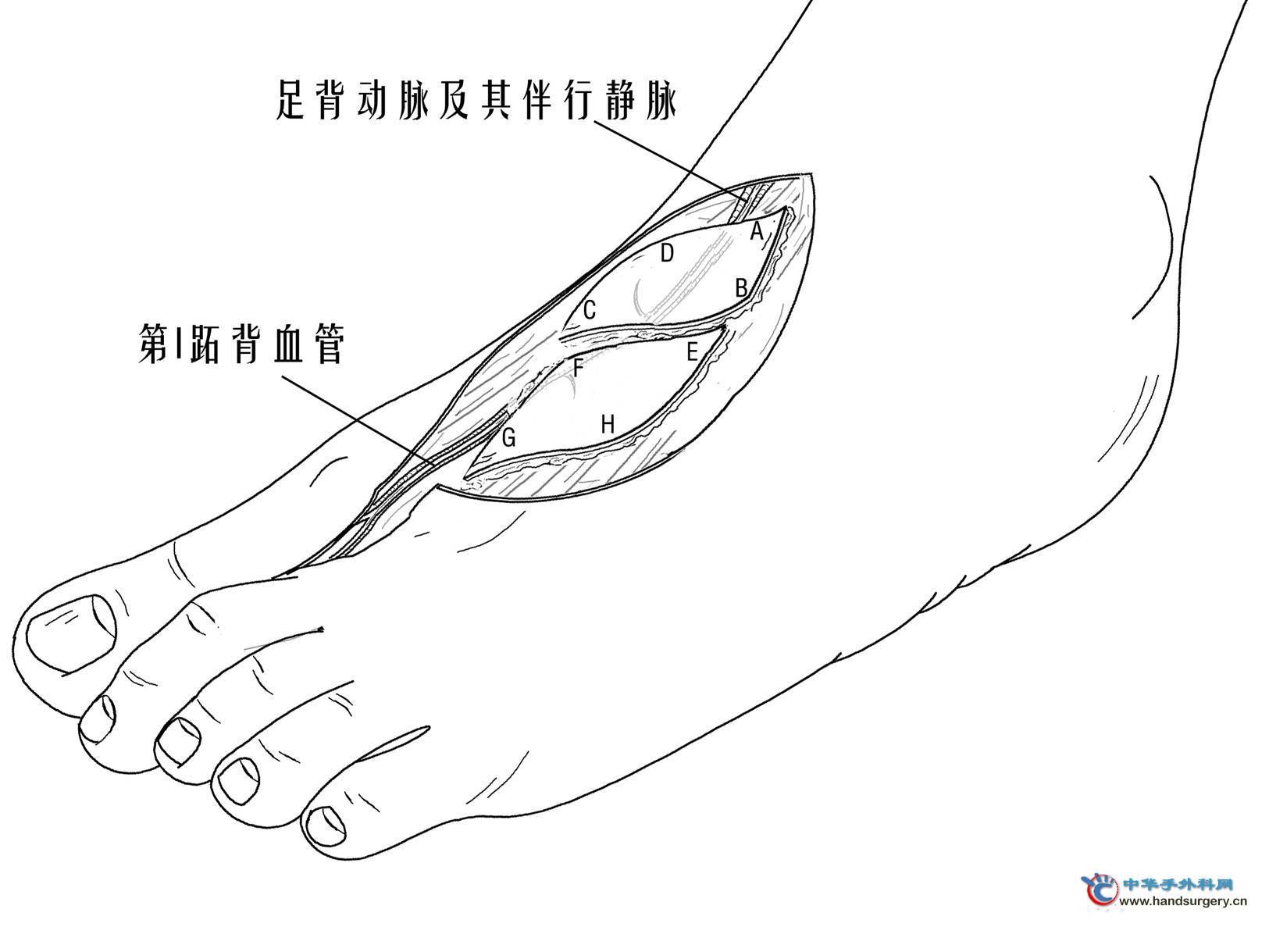 dorsal artery of foot:于伸肌上支持带下缘续于胫前动脉,在踝关节