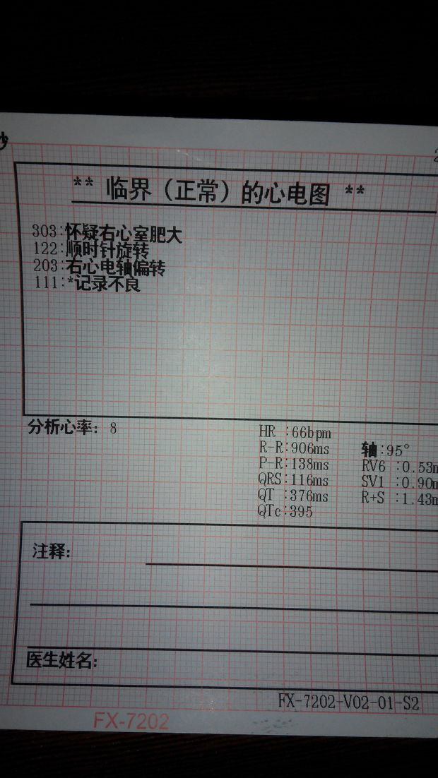 500例征兵体检心电图分析