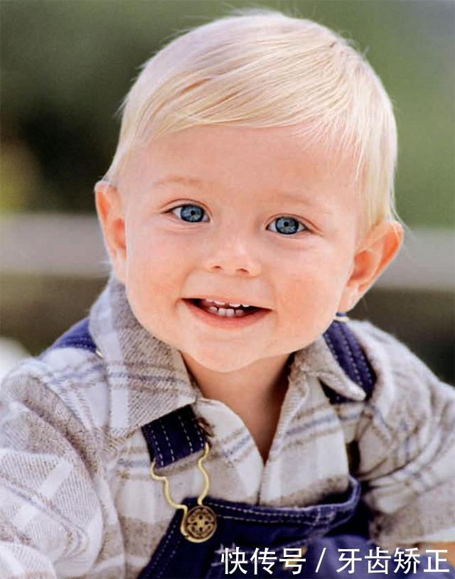 看大意家长是怎么造成小孩奶瓶龋的!