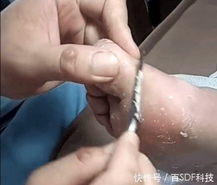 女子八年不洗脚,都变成这个样子了,真的是很无语!