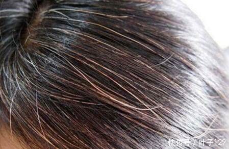 经常吃黑芝麻、黑豆、黑米真能让白发变黑吗?