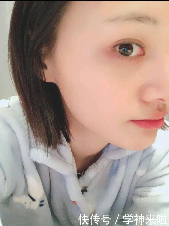 郑爽出席《这就是铁甲》发布会,眼睛受伤纱布