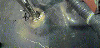 网架螺栓是怎么掏出来的(网架螺栓断裂原因分析) 结构砌体设计 第2张 网架螺栓是怎么掏出来的(网架螺栓断裂原因分析) 结构砌体设计 第2张