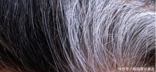 农村老人都说吃黑芝麻能让头发变黑, 这种说法