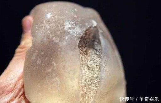 女子洗澡出来后发觉身体不对劲,到医院检查后