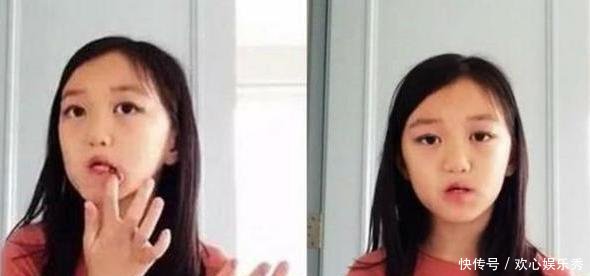 李亚鹏晒李嫣最新正面照,经过多次治疗,她的唇