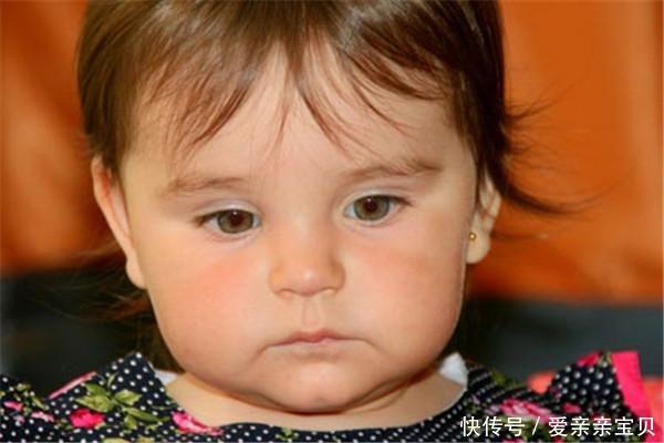 新生儿黄疸值多少算正常?宝宝有黄疸家人需要