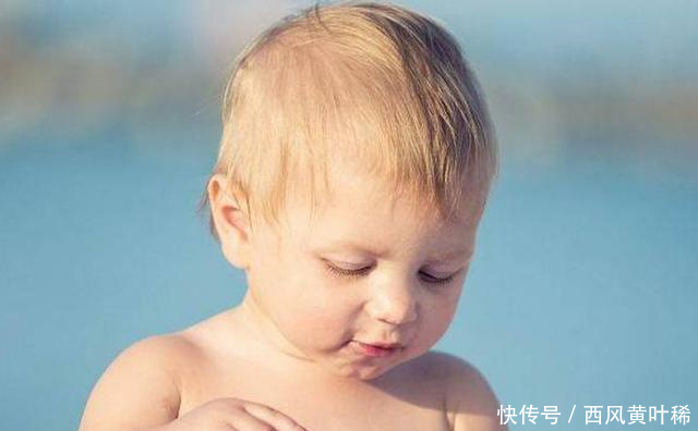 不满三岁的宝宝夏天最容易得这种病,孩子的身