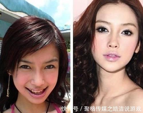 整容过度的明星,整容过度会怎样