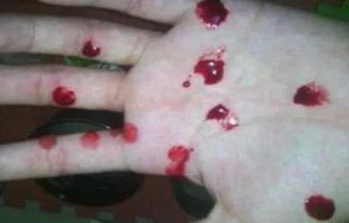 2岁男孩流鼻血,母亲让他抬起头止血,没想到却