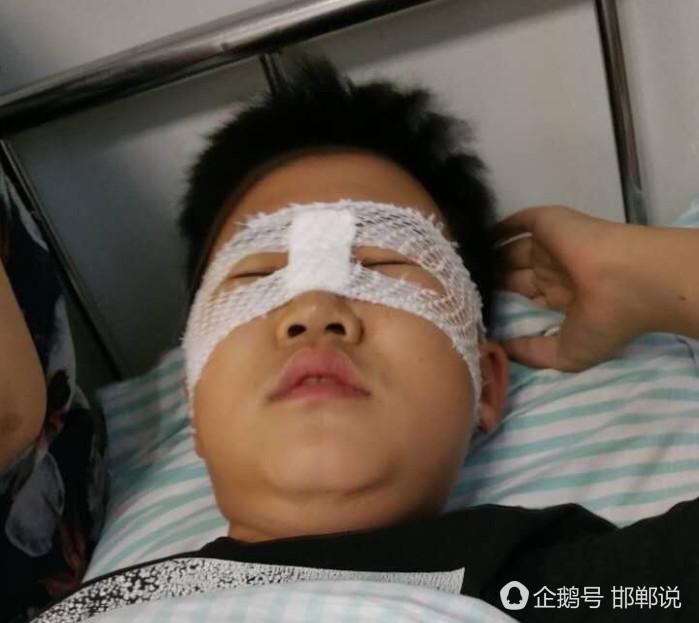 邯郸市三中老师打学生,致使鼻梁骨骨折