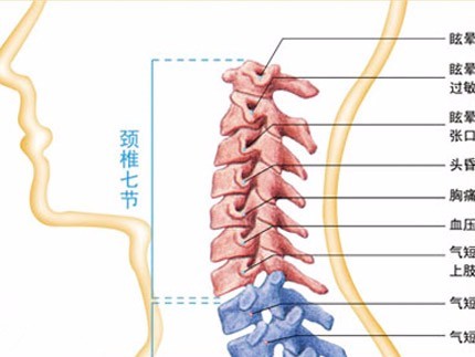颈椎病是指颈椎间盘退行性变及其继发椎间关节退行改变所致相邻