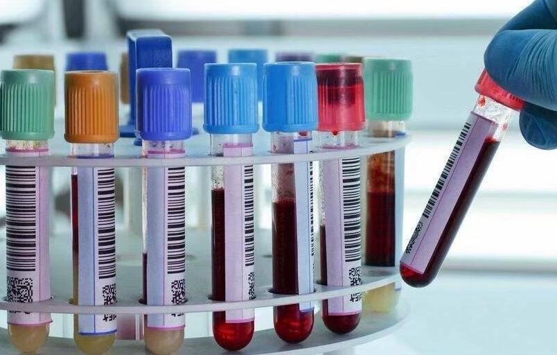 血液在清晨醒来:常规体检抽血所思