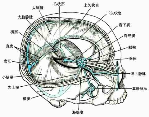 sinus and superior petrosal sinus,即乙状窦,横窦及岩上窦汇合处