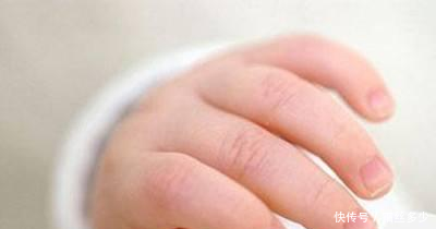 孩子手部都长湿疹怎么办