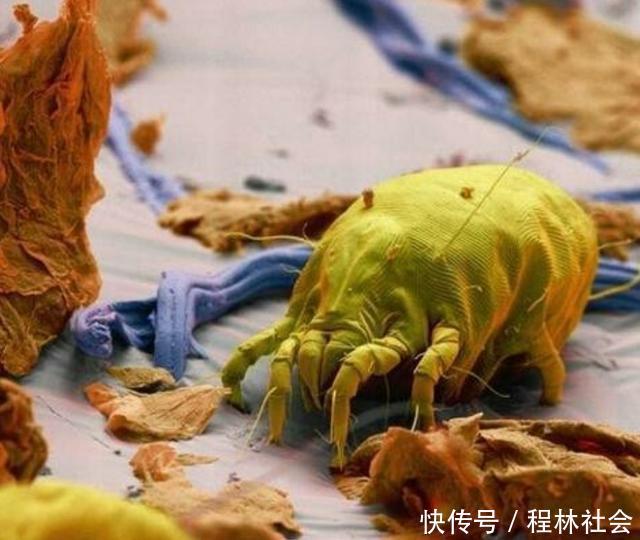 头上出现4个变化,是螨虫已爬入毛囊征兆,很多