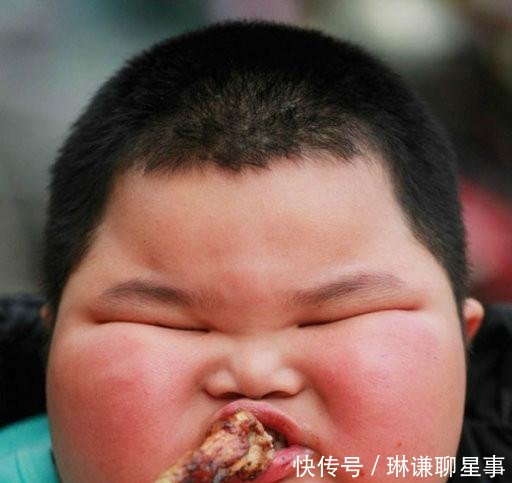 中国最胖的儿童三岁120斤, 智商却很超前, 医生