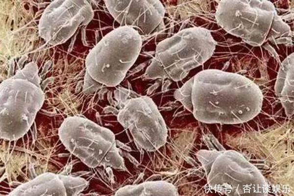 它是螨虫的克星!放在床垫下,再也不怕床上有螨