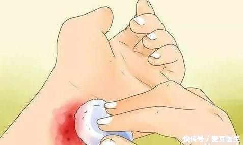 癌症前期的七大征兆,越早知道越好