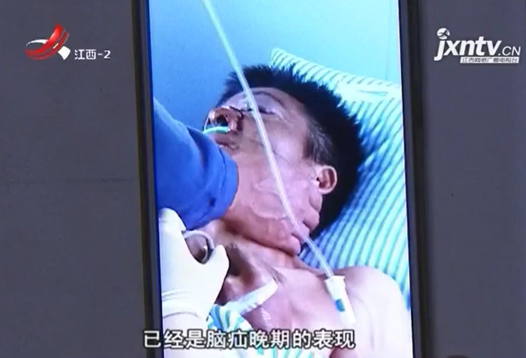 草丛里突然射出东西 江西男子头颅被贯穿