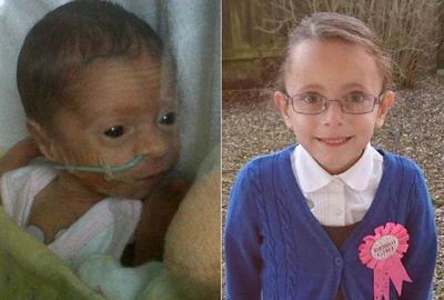 40岁患病母亲生下1斤多点女婴，当时没有玩具大如今6岁很健康_图1