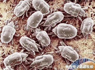 床上用品需要除螨虫吗?