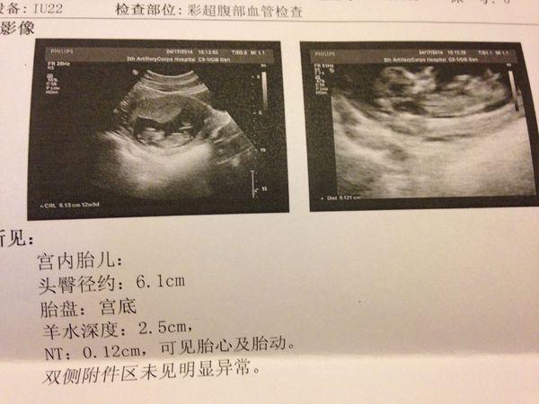 男孩,我老公嘴上不说,其实心里特别喜欢男宝,所以我一向有什么方法