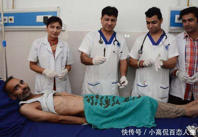 男子肚子疼疑似急性阑尾炎, 去医院检查后, 竟取