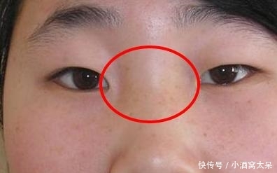 鼻子上有这两条线,福薄命浅苦无边,嫁之前看清楚 pp王者电子游戏