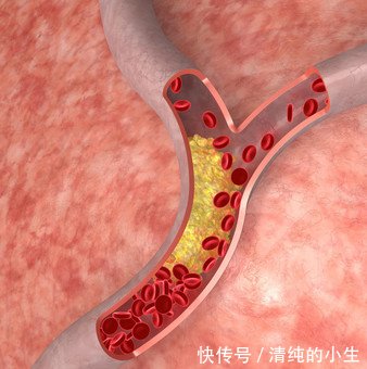 大葱和它俩一起吃,一辈子血管干干净净,远离高