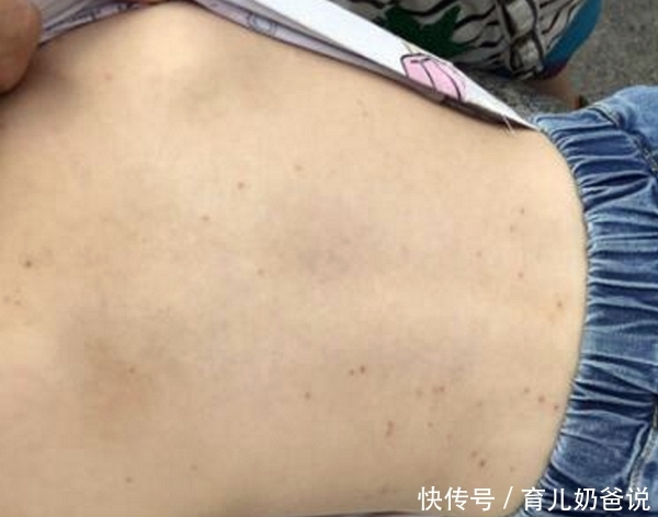 成都9名儿童因玩水染病?夏季带孩子玩水,这几