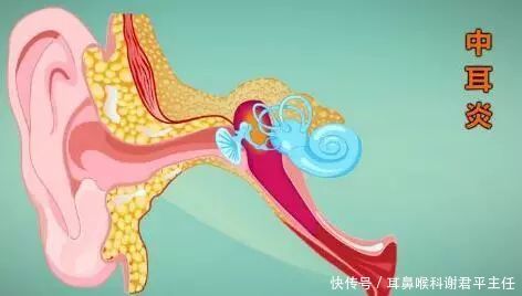 中耳炎早期有五个信号,千万要记住!