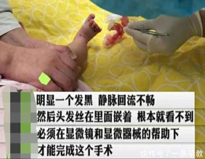 四个月的宝宝哭闹不止, 医生扯下宝宝的袜子后