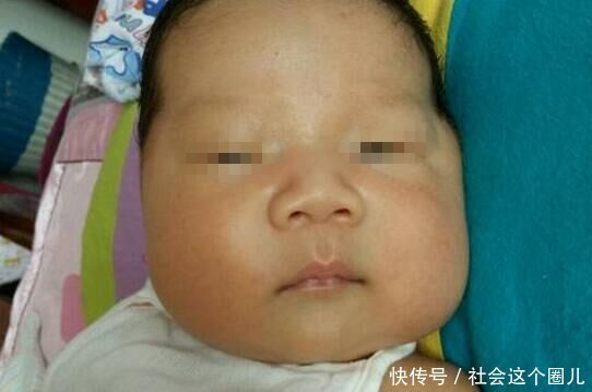 1岁宝宝舌头突然肿大,医生检查完,丈夫毅然抛