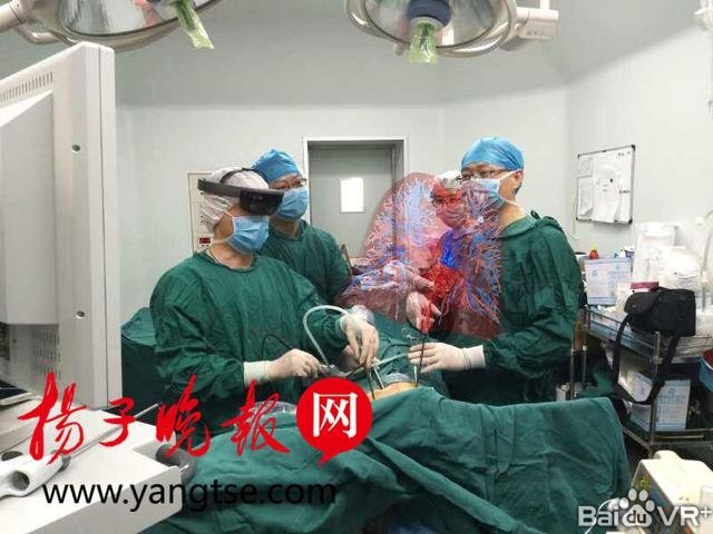 省人民医院胸外科陈亮(左一)教授在术中佩戴mr技术装备为患者做手术
