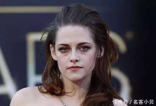 小贝分享:熬夜导致黑眼圈,买了最贵的眼霜奈何解决不了,咋办?