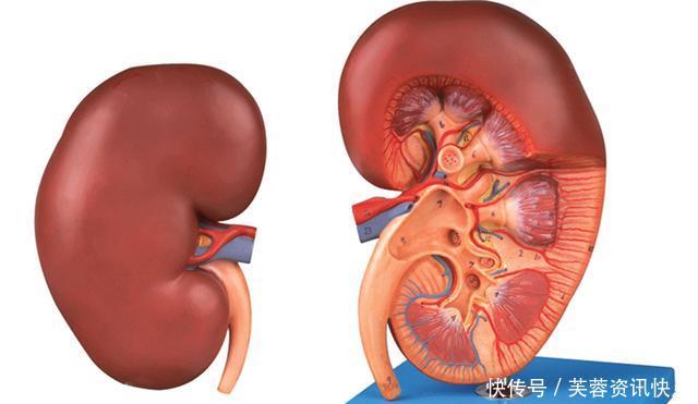 两大原因导致尿酸偏高,饮食上注意一些小细节