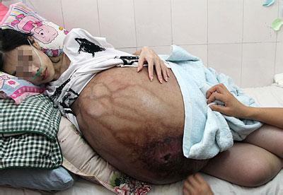 17岁小情侣想打掉腹中胎儿,医生掀开衣服却说:叫你父母来