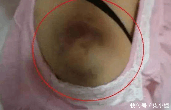 两男一女开房, 服务员发现不对劲趴门缝一看, 吓得赶紧报警