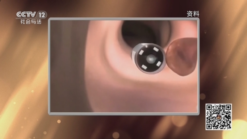 夕阳红 《夕阳红》 20250614 肠道密码——新技术能突破肠道谜题吗？