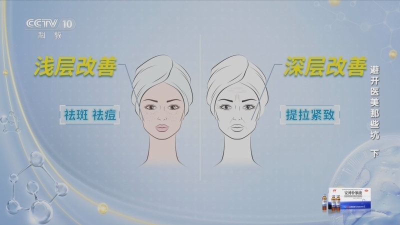 健康之路 《健康之路》 20230628 避开医美那些坑（下）