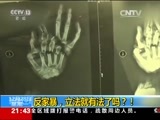 新闻1+1 《新闻1+1》 20151228 反家暴立法就有法了么？