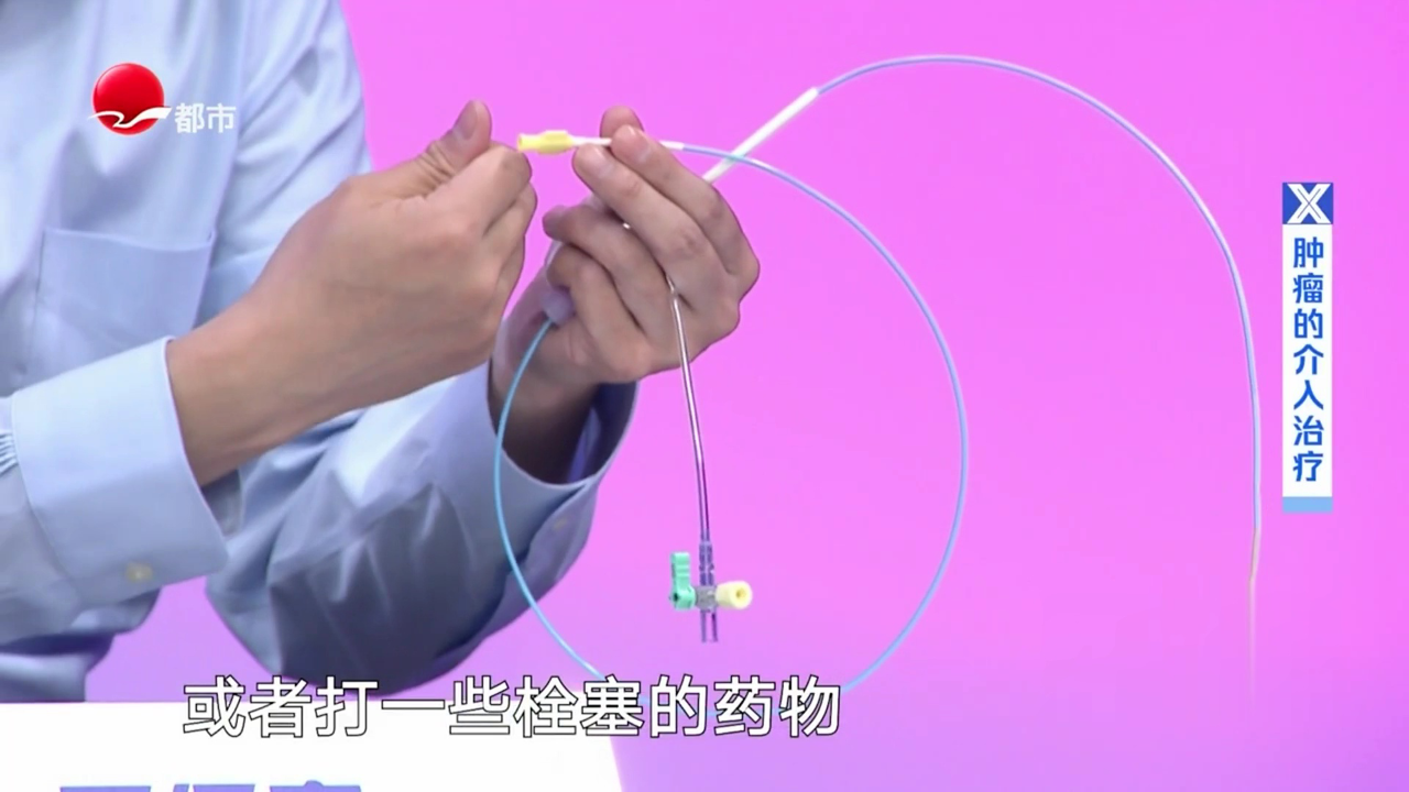X诊所. 肿瘤的介入治疗