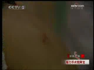 健康之路 接力手术救阿宝