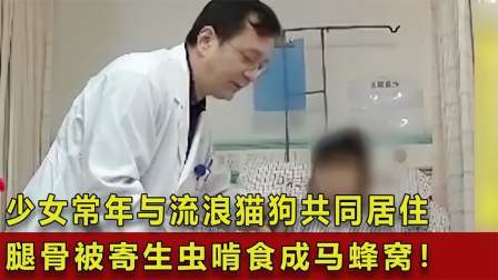 品人生百味第二季 少女常年与流浪猫狗共同居住，腿骨被寄生虫啃食成马蜂窝！