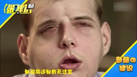 涨健识 世界首例换脸手术的成功