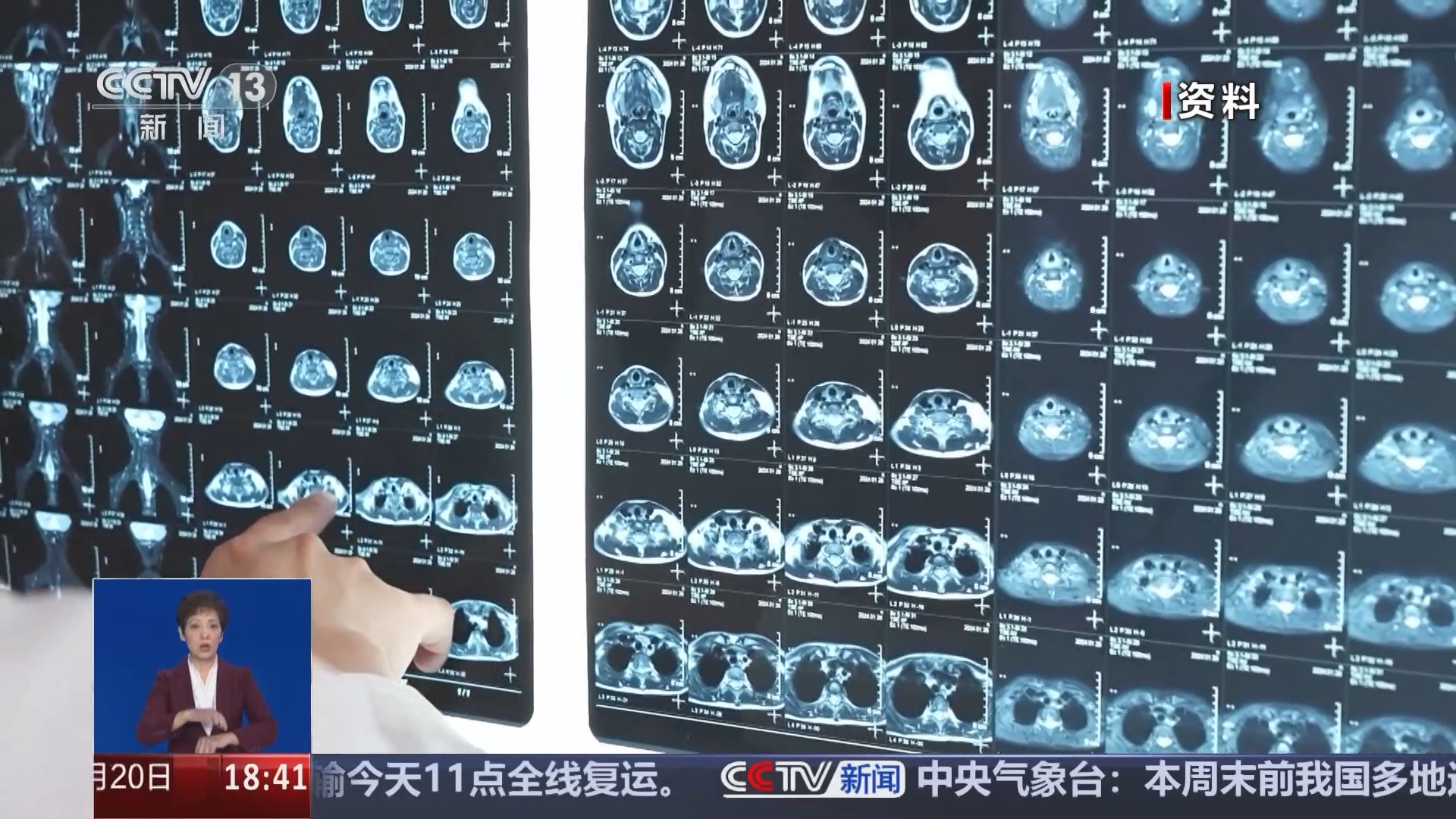 共同关注 《共同关注》 20241120